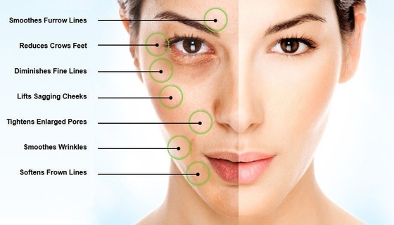 EINECS 232-678-0 히알루론산 파우더 2000- 5000 달톤 순수한 히알루론산 혈청 파우더